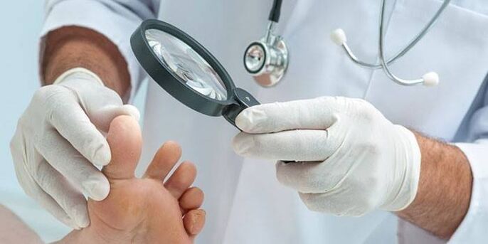 The doctor examines a patient's foot with a spike with a magnifying glass