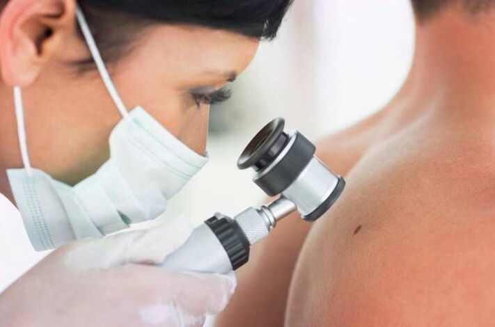 The doctor examines papilloma